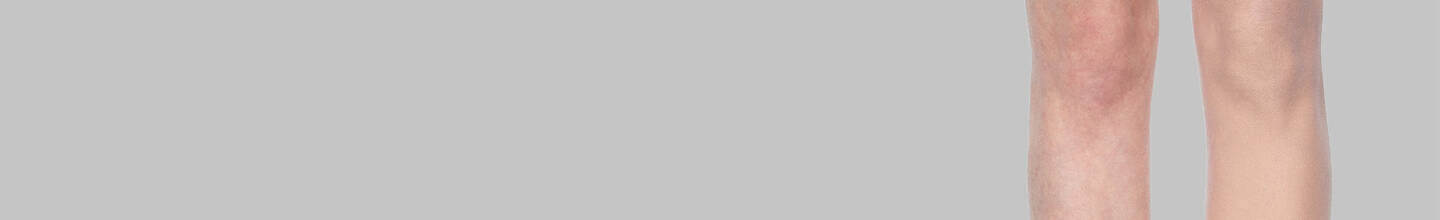 Makeup to Cover Stretch Marks