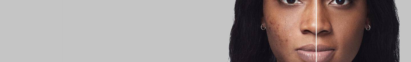 Foundation for Dark Spots